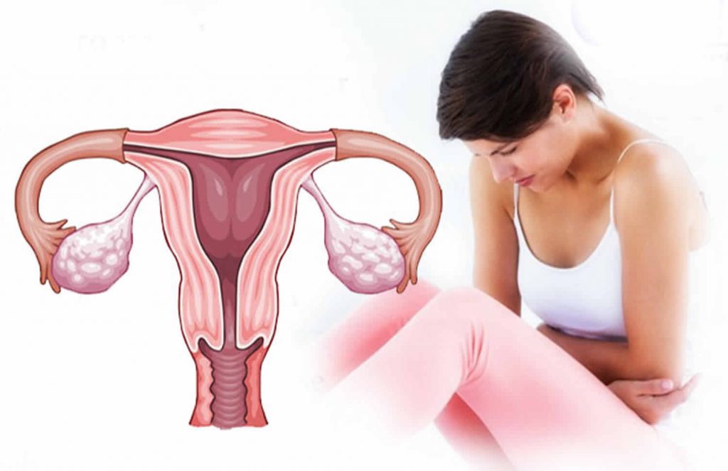 Can Abnormal Uterine Bleeding Lead To Infertility?