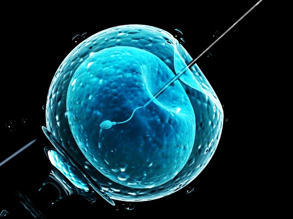 What You Need To Know About Intracytoplasmic Sperm Injection