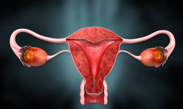 Understanding Inflammation Of The Upper Female Reproductive Tract